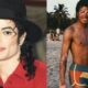 Michael Jackson vitiligo